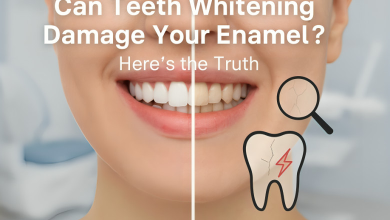 Can Teeth Whitening Damage Your Enamel? Here’s the Truth