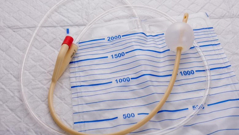 Catheter Manufacturing Plant: Machinery Requirements, Raw Materials and Business Plan