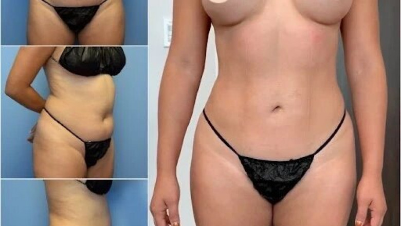 The Best Body Contouring Surgeon in dubai: Experience and Expertise You Can Trust
