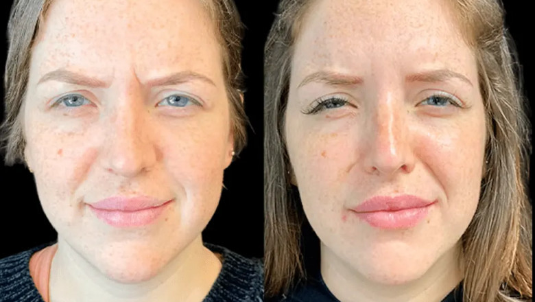 Customized Beauty Plans Only at the Best Aesthetic Clinic in Dubai
