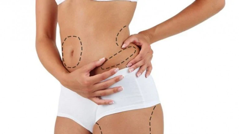 Liposuction in Dubai: Exploring the Latest Technologies in Liposuction