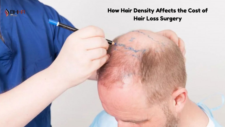 How Hair Density Affects the Cost of Hair Loss Surgery