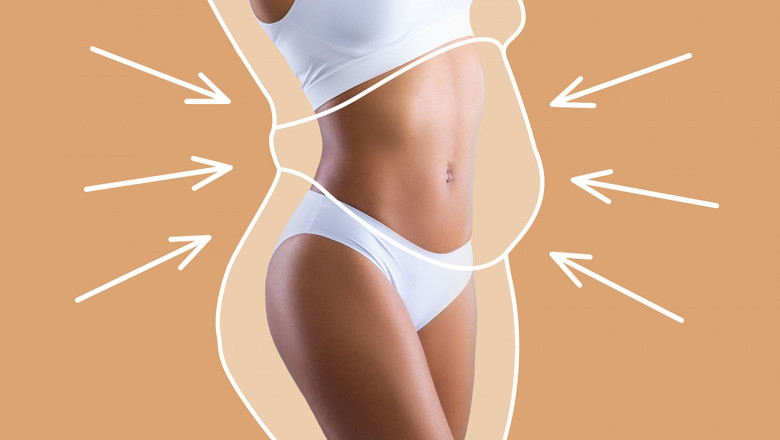 Revision Plastic Surgery in Dubai: Fixing Botched Liposuction the Right Way