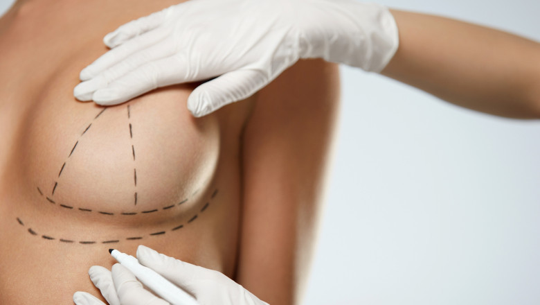 Breast Augmentation Surgery in Riyadh