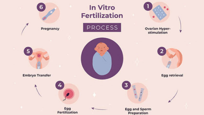 IVF treatment cost in delhi - Dr Rhythm Gupta
