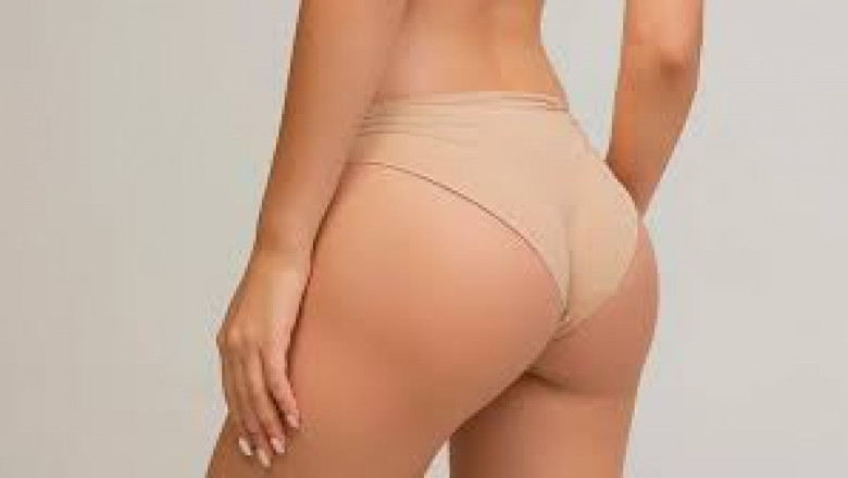 Can Buttock Augmentation Improve Hip Dips or Flatness?