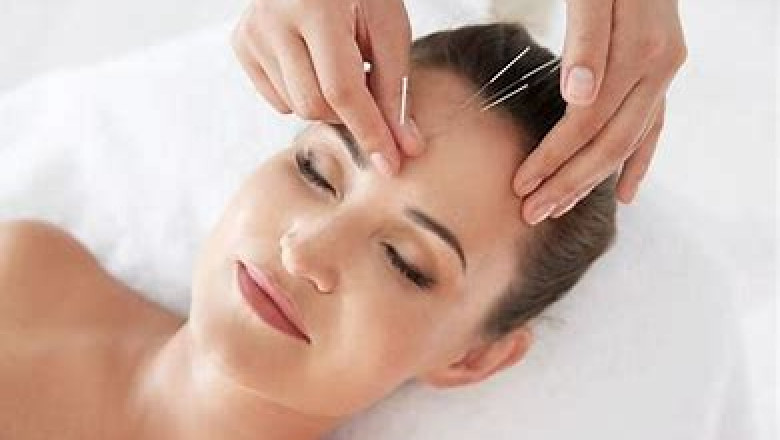 Latest Advancements in Acupuncture Techniques and Tools (2025)