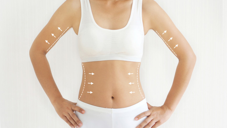 The Role of Experience in Finding the Best Fat Transfer Surgeons in Dubai