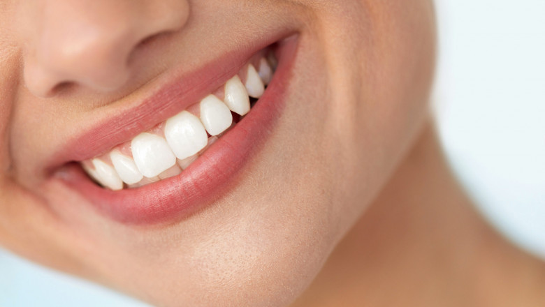 The Cost of Veneers in Dubai: Is It Worth the Investment for Your Smile?