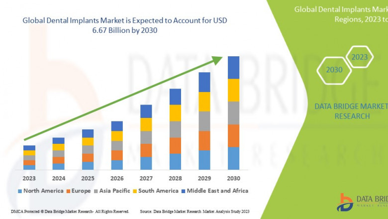 Belgium Dental Implant Market Set for Strong Growth Amid Rising Demand for Advanced Oral Care Solutions
